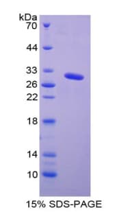 Mouse GLA / Alpha Galactosidase Protein (Recombinant His-T7)