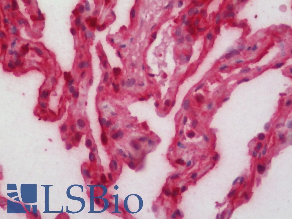 IHC-plus™ AGER / RAGE Antibody