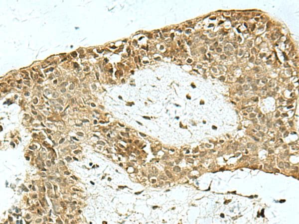 MYST2 / HBO1 Antibody