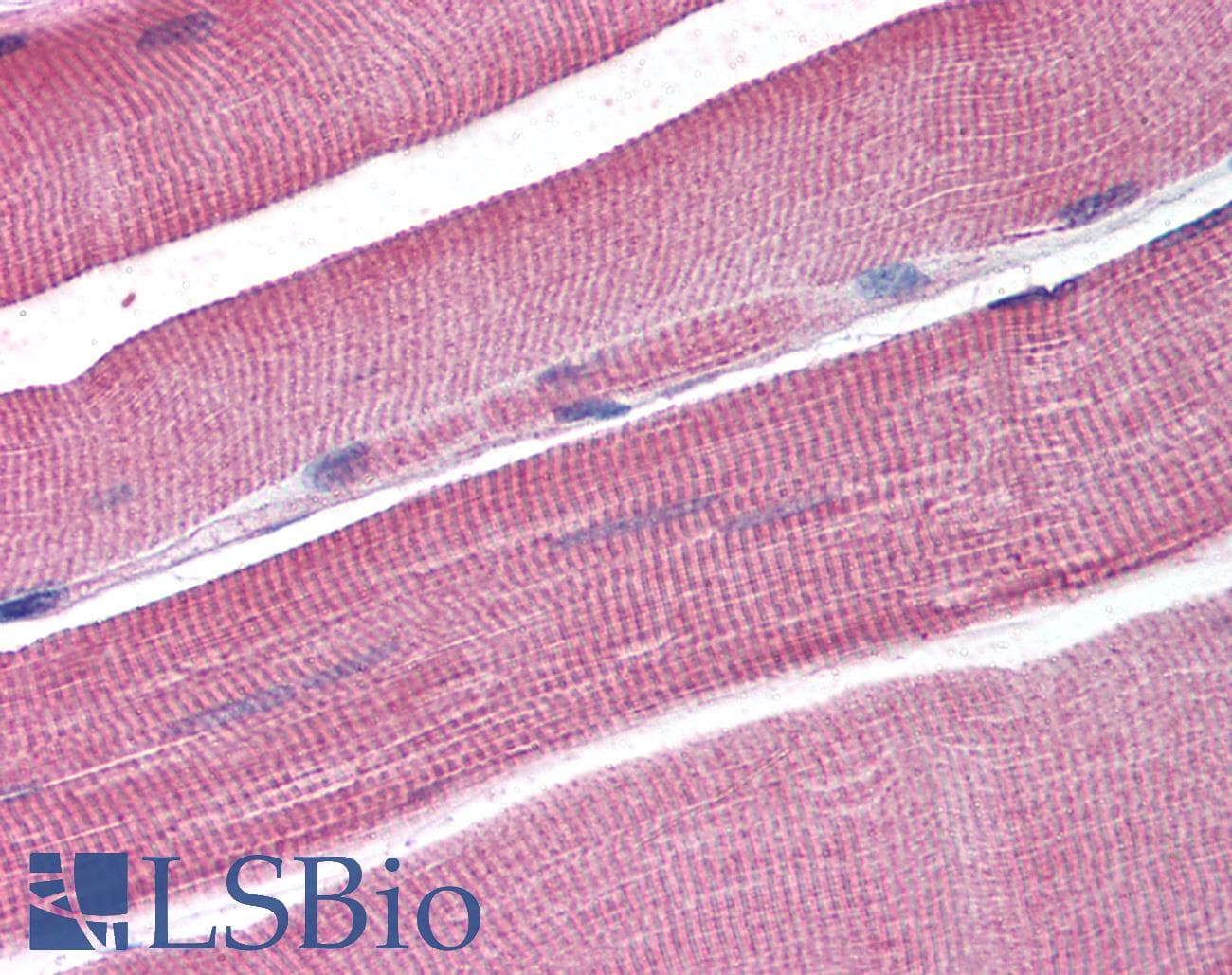 IHC-plus™ DCLRE1A / SNM1 Antibody (aa397-410)