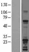SNAP23 / SNAP-23 Protein (Over-Expression Lysate Myc-DDK (Flag))