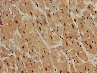 IHC-plus™ DDR2 Antibody