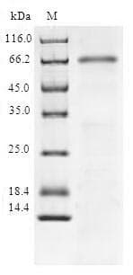 Human SIRT6 / Sirtuin 6 Protein (Recombinant GST, N-terminus)