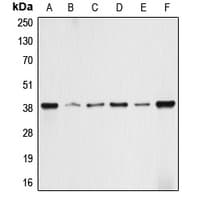 ALDOA / Aldolase A Antibody (N-Terminus)