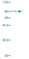 Human SGK1 / SGK Protein (Recombinant GST)
