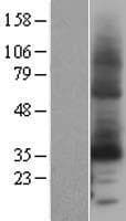 DCYTB / CYBRD1 Protein (Over-Expression Lysate Myc-DDK (Flag))