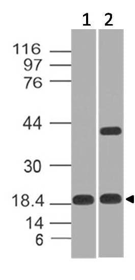 Polyclonal Rabbit anti-Human CELA3B / ELA3B Antibody (WB)