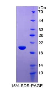 Human FXN / Frataxin Protein (Recombinant His-T7)