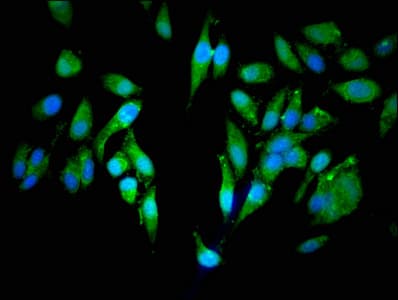 Polyclonal Rabbit anti-Human CEP250 / C-NAP1 Antibody (IF)