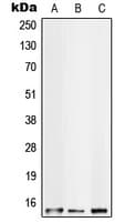 Polyclonal Rabbit anti-Human S100A10 Antibody (Internal, IHC, WB)
