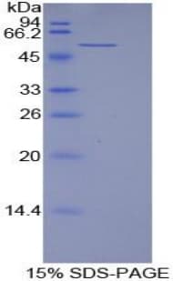 Human LAMB1 / Laminin Beta 1 Protein (Recombinant His, N-Terminal)