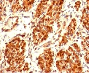 CNN1 / Calponin Antibody (clone CLPN5-1, Ready-to-Use)