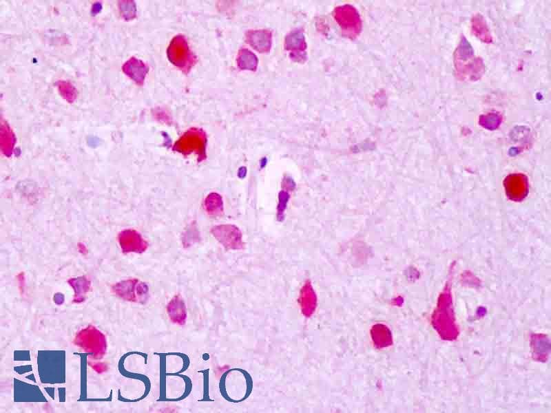 IHC-plus™ CDK2AP1 / DOC1 Antibody (Internal, clone Clone-R76)