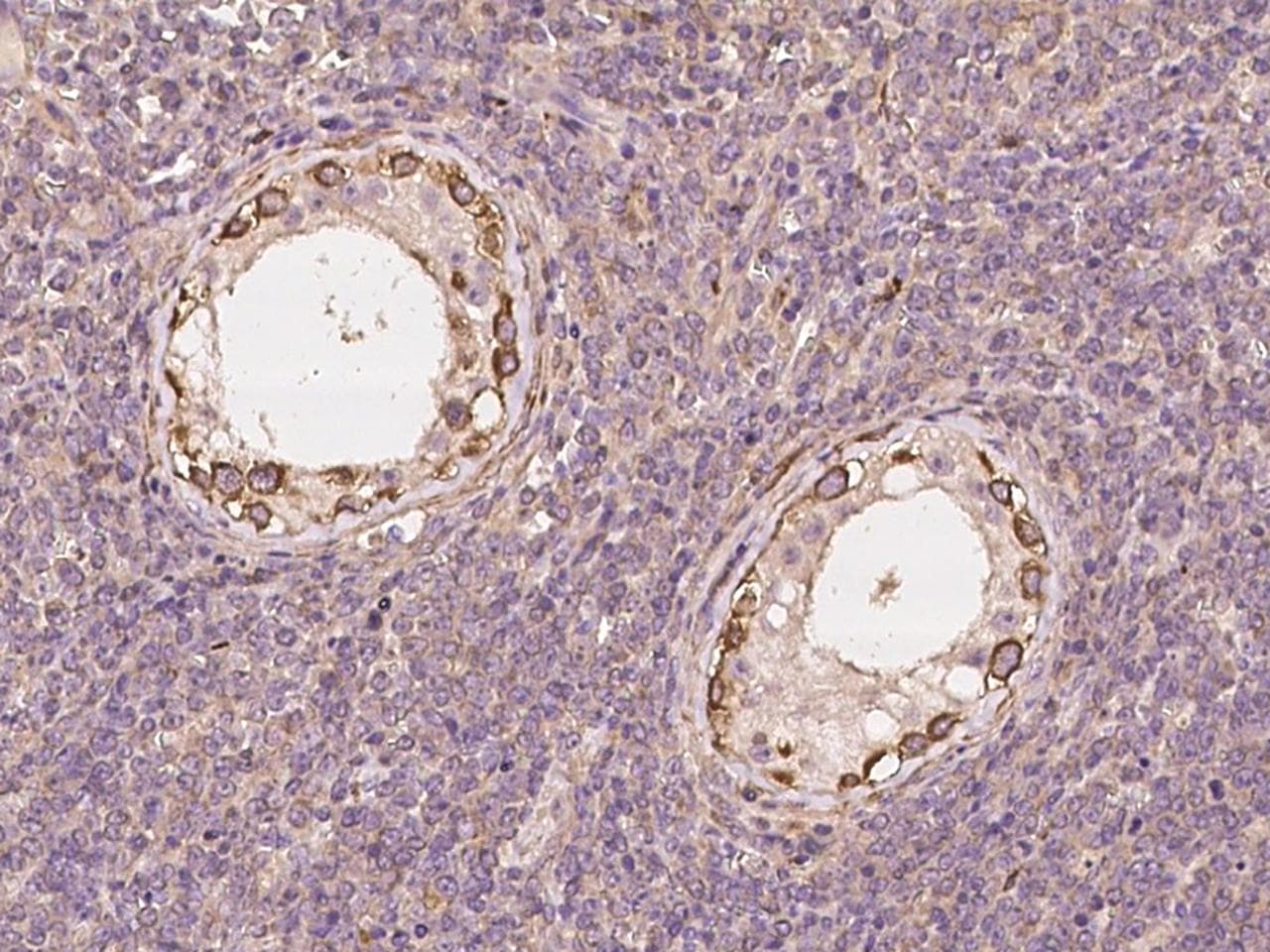 Polyclonal Rabbit anti-Human TRIP13 Antibody (IHC)