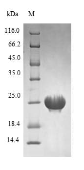 Mycobacterium tuberculosis recR Protein (Recombinant 6His, N-terminus)
