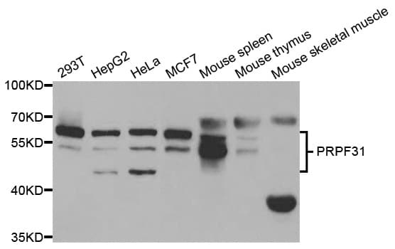 Polyclonal Rabbit anti-Human PRPF31 Antibody (IHC, WB)