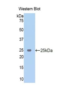 AMBP Antibody (aa18-202)