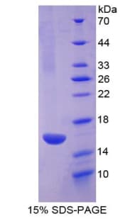 Human RSPO1 / RSPO Protein (Recombinant His-T7)