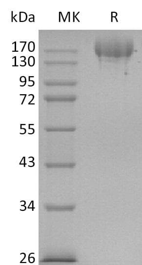 Coronavirus SARS-CoV-2 Spike Glycoprotein (Recombinant 6His, C-terminus)