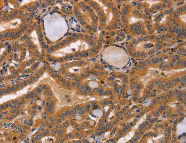 Polyclonal Rabbit anti-Human CCL23 / MIP3 Antibody (IHC)