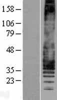 Leukotriene B4 Receptor / BLT1 Protein (Over-Expression Lysate Myc-DDK (Flag))