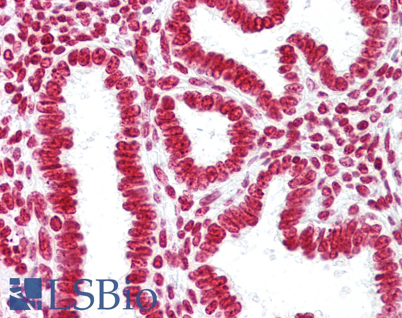 IHC-plus™ Histone H3 Antibody (Methyl-Lys9)