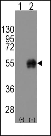 CD14 Antibody (aa292-322)