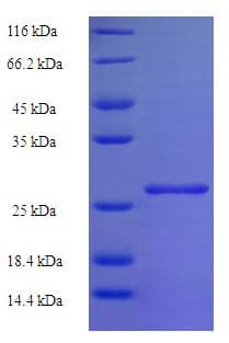 Human HIST1H2BB Protein (Recombinant His-SUMO)