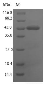 Human CEACAM8 / CD66b Protein (Recombinant 6His-SUMO, N-terminus)