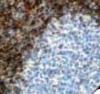 Monoclonal Mouse anti-Human BCL2 / Bcl-2 Antibody (Ready-to-Use, IHC)