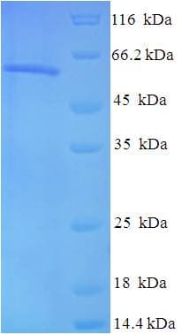 Human CSNK2A1 Protein (Recombinant His-SUMO)