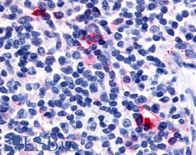 IHC-plus™ CXCR6 Antibody (C-Terminus)