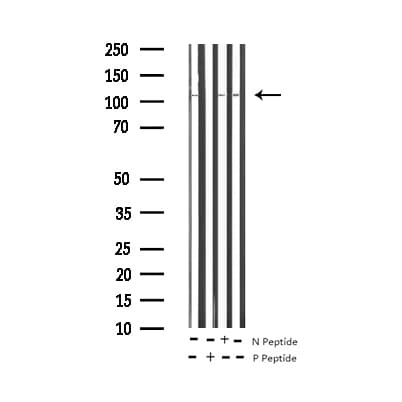NOS3 / eNOS Antibody (phospho-Ser1177)