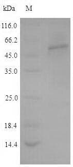 Human TPH2 Protein (Recombinant 6His, N-terminus)
