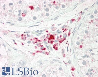 IHC-plus™ LIF Antibody (clone ABM2C57)