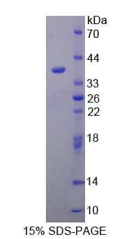 Human CRKL Protein (Recombinant His-T7)