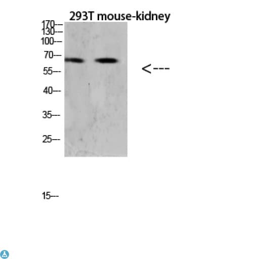 TNFRSF11A / RANK Antibody (aa60-120)