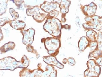 TP / Thymidine Phosphorylase Antibody (clone SPM322, Azide-free, BSA-free)