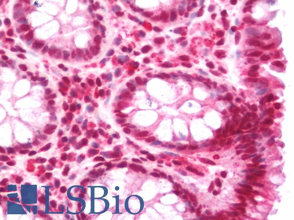IHC-plus™ Polyclonal Rabbit anti-Human SREBF2 / SREBP2 Antibody (IHC, IF, WB)
