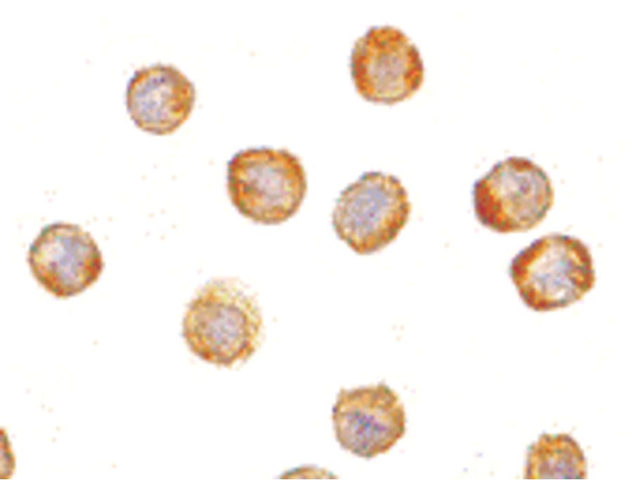 Polyclonal Rabbit anti-Human TDP-43 / TARDBP Antibody (IF, WB)