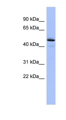 Polyclonal Rabbit anti-Human PCOLCE Antibody (aa251-300, WB)