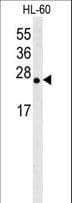 Polyclonal Rabbit anti-Human BCL2L2 / Bcl-w Antibody (aa24-59, IHC, WB)