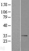 NADK2 / C5orf33 Protein (Over-Expression Lysate Myc-DDK (Flag))