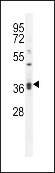 KLHL35 Antibody (aa301-328)