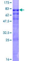 Human MEF2C Protein (Recombinant GST)