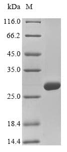 Mouse COL4A2 / Collagen IV Alpha2 Protein (Recombinant 6His-SUMO, N-terminus)