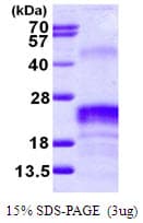 Human VEGFA / VEGF Protein (Recombinant His)