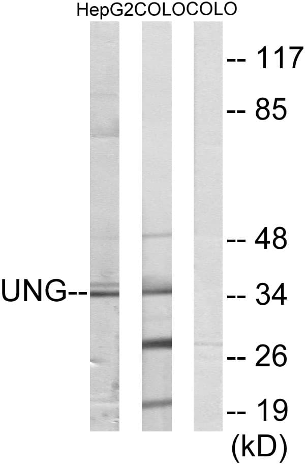 Polyclonal Rabbit anti-Human UNG / Uracil DNA Glycosylase Antibody (aa191-240, WB)