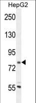 Coronin 7 / CORO7 Antibody (aa173-202)