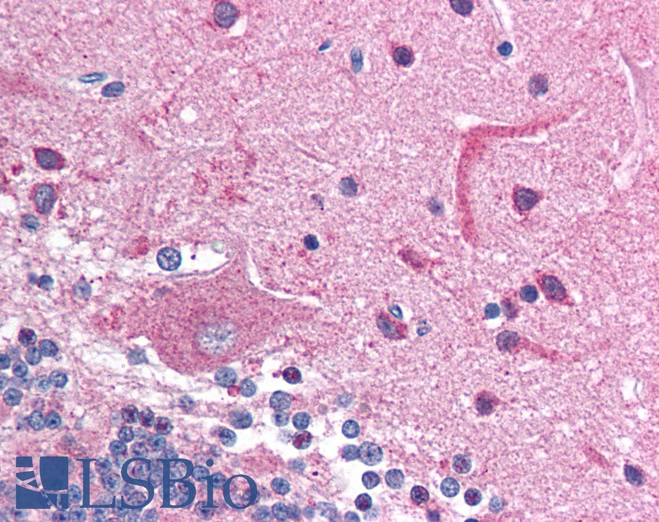 HDAC6 Antibody (aa69-118)